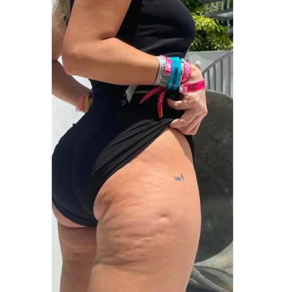 Vacuvia Sculpt Glow -Firmer, More Toned Skin